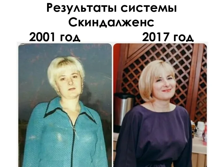 Результаты системы Скиндалженс 2001 год 2017 год