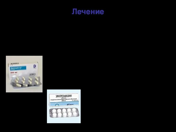 Лечение Нейтрализация токсина путем введения противодифтерийной сыворотки антитоксической (донорской или лошадиной) Антибиотикотерапия: