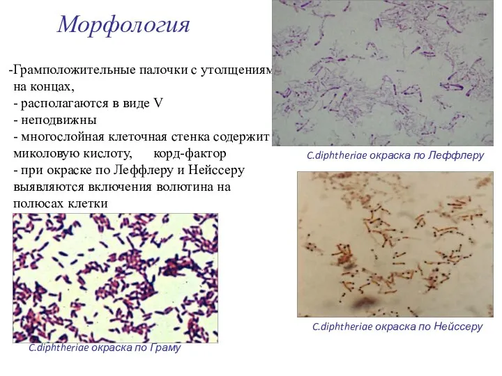 Морфология C.diphtheriae окраска по Леффлеру Грамположительные палочки с утолщениями на концах, -