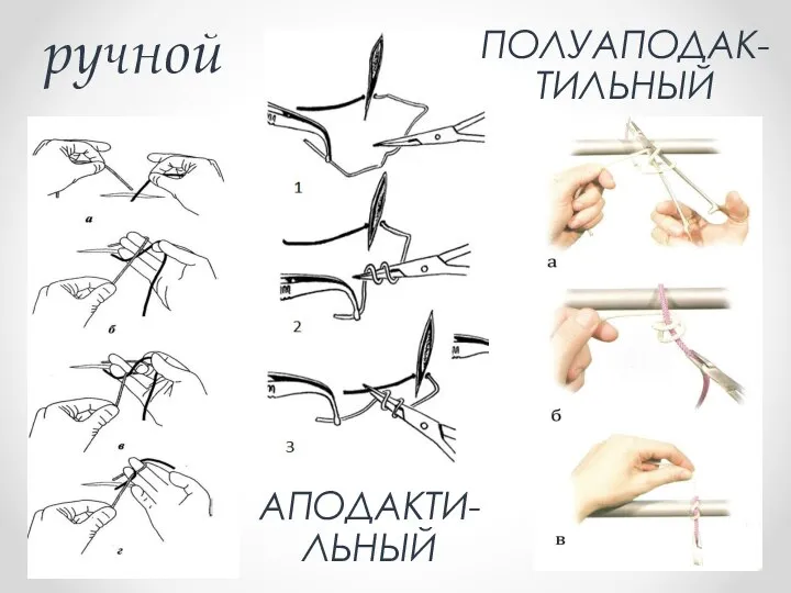 Как вязать хирургический узел руками Узлы в хирургии презентация