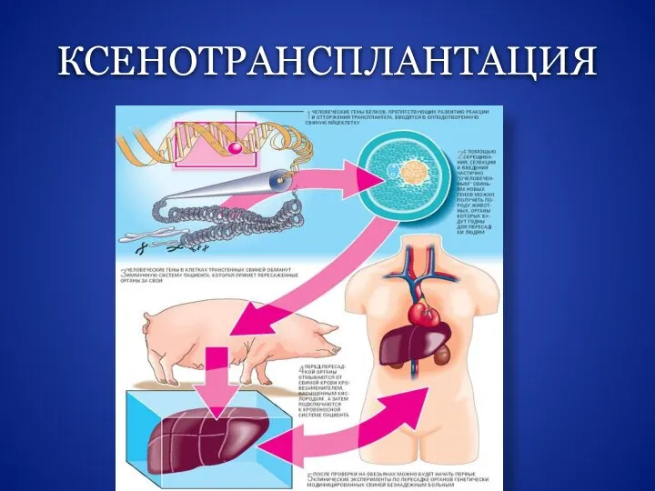 Трансплантология презентация по хирургии