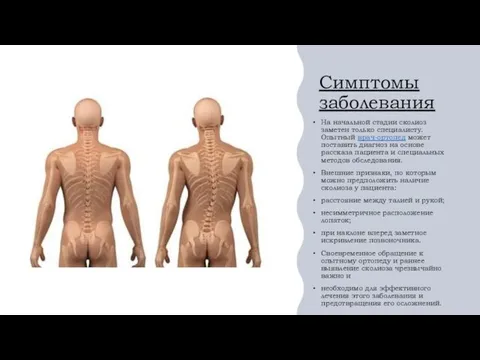 4 степень сколиоза инвалидность