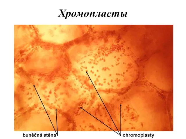 Клетка мякоти рябины. Хромопласты томата микроскопом. Хромопласт микрофотография. Хромопласты моркови микроскопом. Хромопласты шиповника.