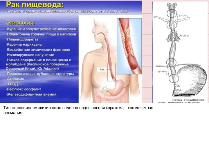 Пластика пищевода по льюису. Сфинктеры желудка и пищевода. Какие болит пищевод. Химический ожог желудка. Какие болит пищевод.
