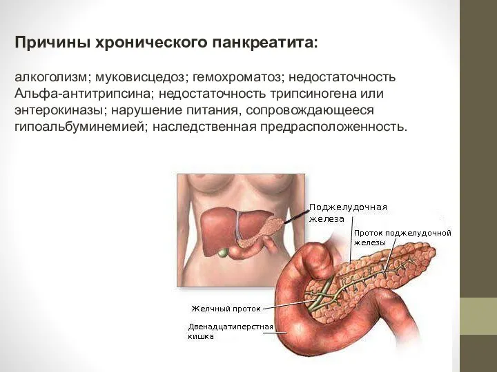 Факторы хронического панкреатита. Хронический алкогольный панкреатит. Хронический панкреатит и алкоголь. Патогенез хронического алкогольного панкреатита по кузину.