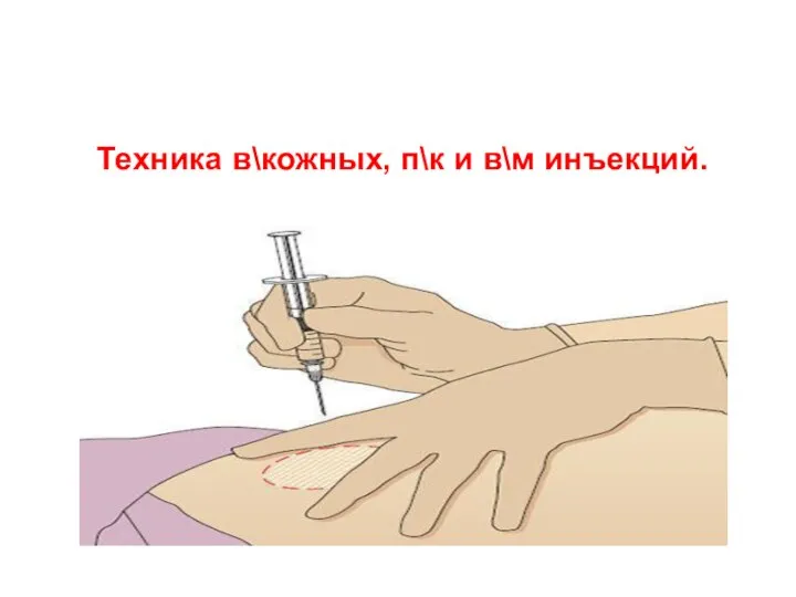 Введение техники оборудования. В/М инъекция. Техника п/к инъекции. Техника в/м инъекции.