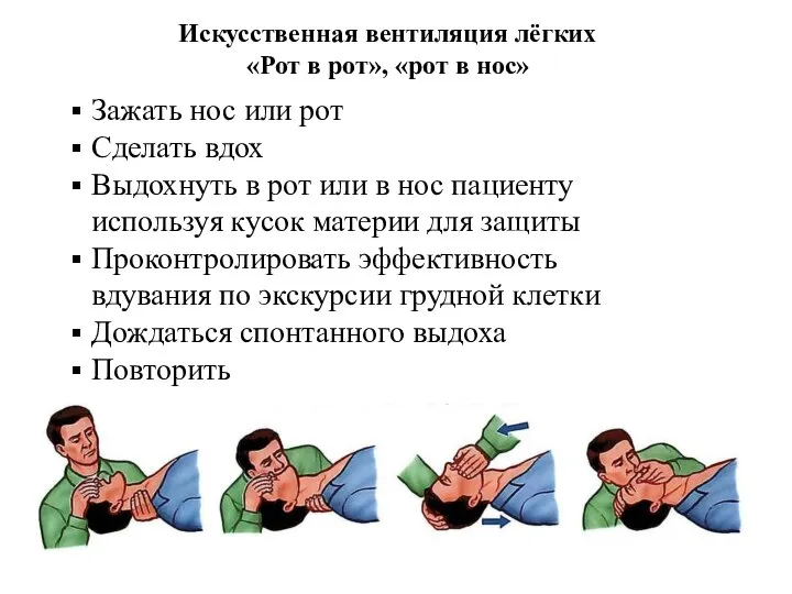Искуственная вентиляция легких алгоритм кратко. Искусственная вентиляция легких рот в нос. Искусственная вентиляция легких методом ‘’рот в нос’’.